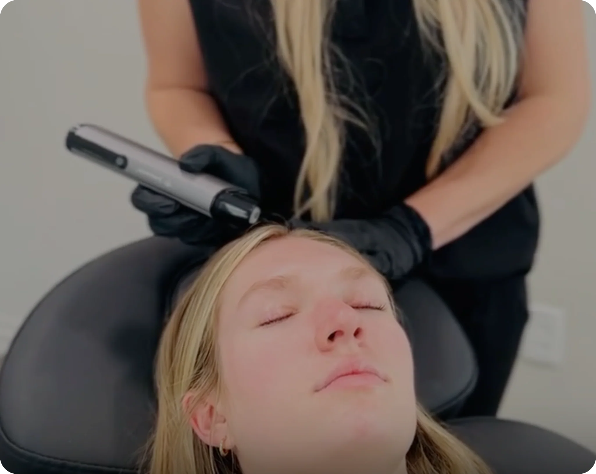 A patient receiving a Juvasonic treatment on her scalp